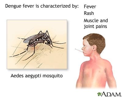 Dengue transmission symptoms