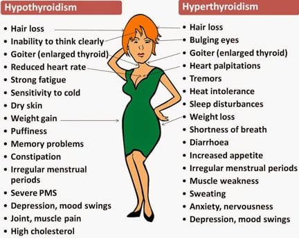 Thyroid dysfunctions