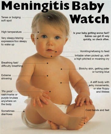 Meningitis Children