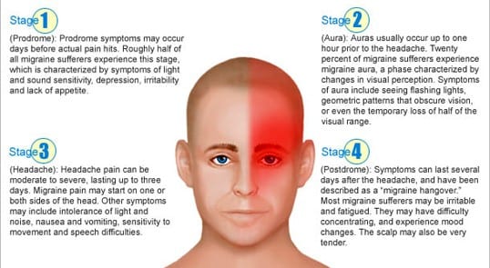 Migraine headache causes stages