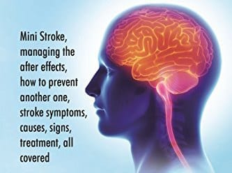 Mini Stroke Signs