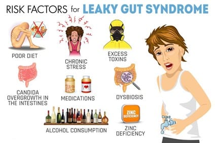 Lazy gut risk factors