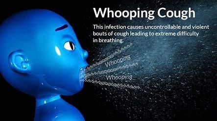 Whooping Cough in Adults