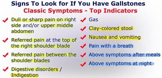 Gallstones Signs Symptoms