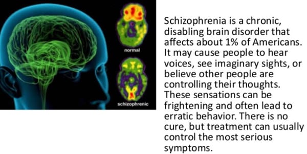 What is schizophrenia disorder