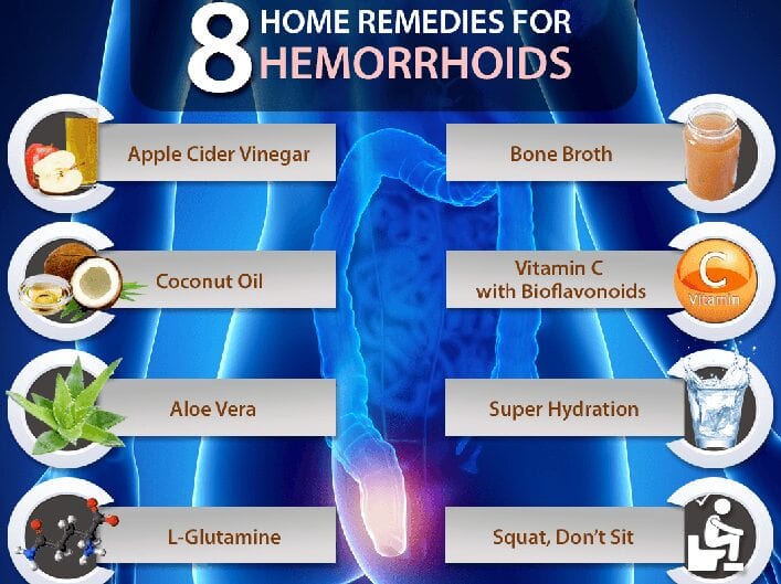 Home treatments hemorrhoids