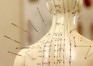 Acupuncture needle point chart