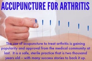 Acupuncture for arthritis needles in back