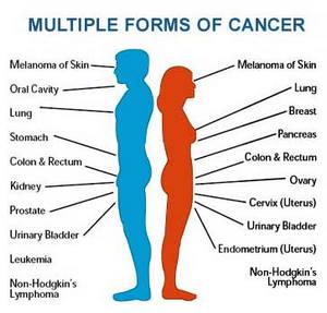 Most Common Cancer List